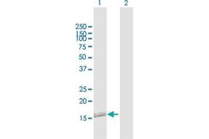 Western Blot analysis of NANOS2 expression in transfected 293T cell line by NANOS2 MaxPab polyclonal antibody. (NANOS2 antibody  (AA 1-138))