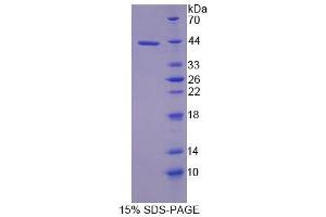 SDS-PAGE analysis of Rat UQCRB Protein.