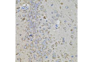 Immunohistochemistry (IHC) image for anti-Secreted phosphoprotein 1 (SPP1) antibody (ABIN1874927)