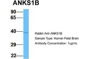 Host: Rabbit Target Name: ANKS1B Sample Type: Human Fetal Brain Antibody Dilution: 1. (ANKS1B antibody  (C-Term))