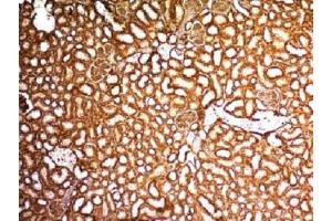 IHC testing of FFPE mouse kidney with WT1 antibody. (WT1 antibody)