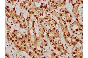 Immunohistochemistry (IHC) image for anti-Small Ubiquitin Related Modifier Protein 1 (SUMO1) antibody (ABIN7127830)