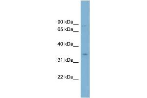 WB Suggested Anti-GPD2 Antibody Titration:  0. (GPD2 antibody  (Middle Region))
