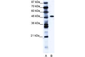 WB Suggested Anti-ZNF541 Antibody Titration: 1. (ZNF541 antibody  (Middle Region))
