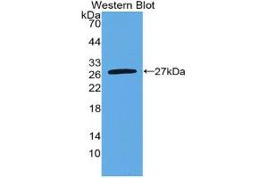 Western blot analysis of the recombinant protein. (Nephrin antibody  (AA 27-234))