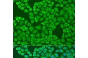 Immunofluorescence analysis of U2OS cells using IFI44 Polyclonal Antibody at dilution of 1:100. (IFI44 antibody)