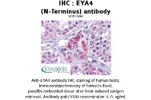 Image no. 2 for anti-Eyes Absent Homolog 4 (EYA4) (N-Term) antibody (ABIN1734196) (EYA4 antibody  (N-Term))
