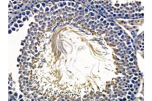 ABIN6258269 and ABIN6273857 at 1/100 staining rat testis tissue by IHC-P.