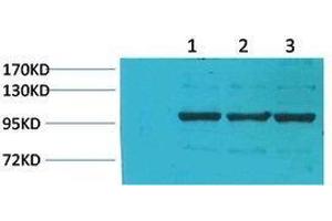 Western Blot (WB) analysis of 1) Pig Skeletal MuscleTissue, 2) Rat Skeletal Muscle Tissue, 3) Rat Skeletal Muscle Tissue using IGFN1 Polyclonal Antibody. (IGFN1 antibody)
