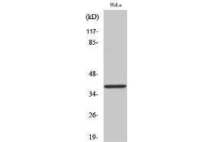 Western Blotting (WB) image for anti-Mitogen-Activated Protein Kinase Kinase 3 (MAP2K3) (pSer218) antibody (ABIN3182069) (MAP2K3 antibody  (pSer218))