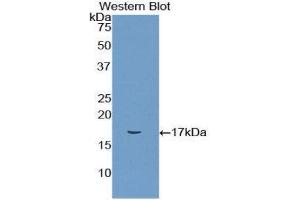 Western Blotting (WB) image for anti-CD72 Molecule (CD72) (AA 126-237) antibody (ABIN1858315) (CD72 antibody  (AA 126-237))