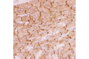 Immunohistochemistry (IHC) image for anti-Desmin (DES) (AA 1-304) antibody (ABIN3043265)