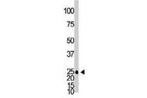 The GJB2 polyclonal antibody  is used in Western blot to detect GJB2 in mouse brain tissue lysate. (GJB2 antibody  (C-Term))