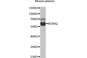 Western blot analysis of extracts of mouse plasma, using KCN antibody (ABIN6129438, ABIN6142695, ABIN6142696 and ABIN6221897) at 1:1000 dilution. (KCNA2 antibody  (AA 1-165))