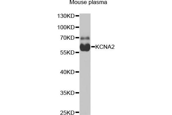 KCNA2 Antikörper  (AA 1-165)