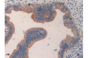 IHC-P analysis of Mouse Uterus Tissue, with DAB staining. (CCL7 antibody  (AA 28-97))