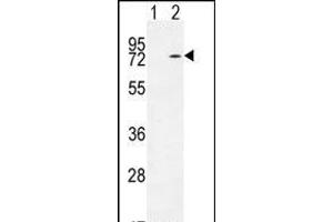 Western blot analysis of KARS (arrow) using rabbit polyclonal KARS Antibody (N-term) (ABIN655049 and ABIN2844677). (KARS antibody  (N-Term))