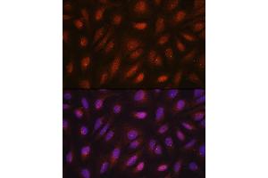 Immunofluorescence analysis of U2OS cells using CETN3 antibody (ABIN7268452) at dilution of 1:100. (CETN3 antibody  (AA 1-167))
