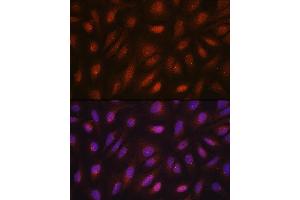 Immunofluorescence analysis of U2OS cells using CETN3 antibody (ABIN7268452) at dilution of 1:100. (CETN3 antibody  (AA 1-167))