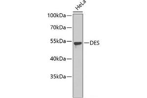Western blot analysis of extracts of HeLa cells using DES Polyclonal Antibody. (Desmin antibody)
