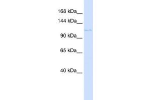 WB Suggested Anti-PTCH2 Antibody Titration:  0. (Patched 2 antibody  (N-Term))