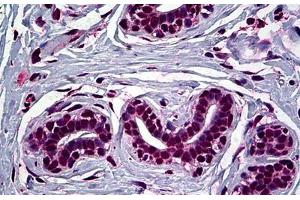 Human Breast: Formalin-Fixed, Paraffin-Embedded (FFPE) (FOXA2 antibody  (AA 363-458))