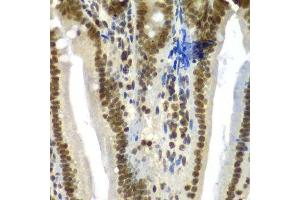 Immunohistochemistry (Paraffin-embedded Sections) (IHC (p)) image for anti-Splicing Factor 3b, Subunit 2, 145kDa (SF3B2) (AA 616-895) antibody (ABIN6147666)