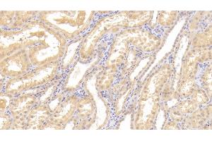 Detection of Tie1 in Human Kidney Tissue using Polyclonal Antibody to Tyrosine Kinase With Immunoglobulin Like And EGF Like Domains Protein 1 (Tie1) (TIE1 antibody  (AA 435-609))