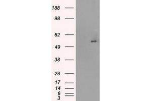 HEK293T cells were transfected with the pCMV6-ENTRY control (Left lane) or pCMV6-ENTRY SLC2A5 (Right lane) cDNA for 48 hrs and lysed. (SLC2A5 antibody)