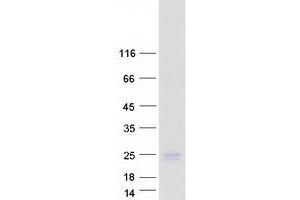 Validation with Western Blot (HN1 Protein (Transcript Variant 3) (Myc-DYKDDDDK Tag))