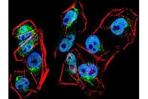 Immunofluorescence (IF) image for anti-PR Domain Containing 1, with ZNF Domain (PRDM1) (AA 690-825) antibody (ABIN5542358)