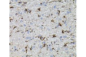 Immunohistochemistry of paraffin-embedded Rat brain using TRPA1 Polyclonal Antibody at dilution of 1:100 (40x lens).