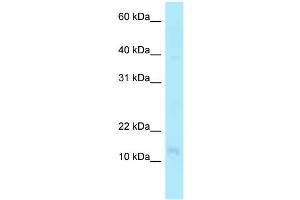 WB Suggested Anti-PFDN4 Antibody Titration: 1. (PFDN4 antibody  (N-Term))