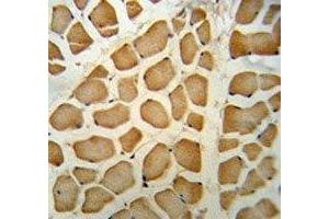 NPEPPS antibody IHC analysis in formalin fixed and paraffin embedded human skeletal muscle. (NPEPPS antibody  (AA 709-737))