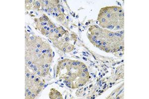 Immunohistochemistry of paraffin-embedded human stomach using NDUFA6 antibody (ABIN6003563) at dilution of 1/100 (40x lens).