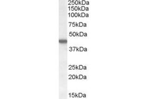 ABIN238540 (1µg/ml) staining of HEK293 cell lysate (35µg protein in RIPA buffer). (CK1 epsilon antibody  (C-Term))