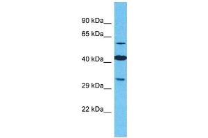 Western Blotting (WB) image for anti-Olfactory Receptor, Family 2, Subfamily M, Member 4 (OR2M4) (C-Term) antibody (ABIN2791726) (OR2M4 antibody  (C-Term))