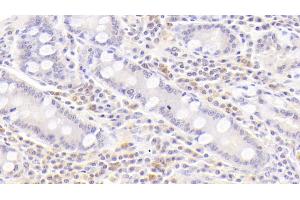 Immunohistochemistry (IHC) image for anti-Tumor Necrosis Factor Receptor Superfamily, Member 13C (TNFRSF13C) (AA 96-184) antibody (ABIN7438967)