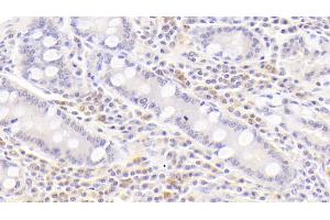 Detection of BAFFR in Human Small intestine Tissue using Polyclonal Antibody to B-Cell Activation Factor Receptor (BAFFR) (BAFF antibody  (AA 96-184))