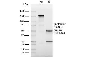 SDS-PAGE Analysis Purified CD19 Monospecific Mouse Monoclonal Antibody (CD19/3117). (CD19 antibody  (AA 96-281))