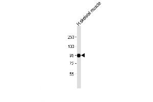 Western Blot at 1:8000 dilution + human skeletal muscle lysate Lysates/proteins at 20 ug per lane. (PYGM antibody  (C-Term))