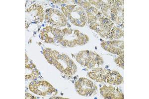 Immunohistochemistry of paraffin-embedded human stomach using VEPH1 antibody (ABIN5974616) (40x lens). (VEPH1 antibody)