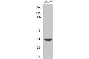 Western Blotting (WB) image for anti-Myeloid Differentiation Primary Response Gene (88) (MYD88) (Internal Region) antibody (ABIN3185721)