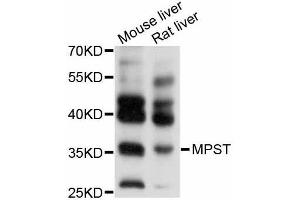 Western blot analysis of extracts of various cell lines, using MPST antibody (ABIN5998252) at 1/1000 dilution.