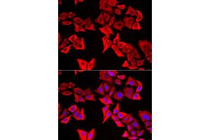 Immunofluorescence analysis of U2OS cells using THRSP antibody (ABIN5974357).
