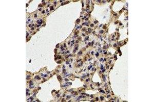Immunohistochemical analysis of CDK6 staining in rat lung  formalin fixed paraffin embedded tissue section. (CDK6 antibody)