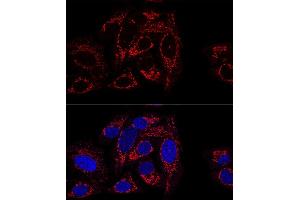 Confocal immunofluorescence analysis of U2OS cells using GCSH antibody (ABIN6127983, ABIN6141032, ABIN6141033 and ABIN6217784) at dilution of 1:100 (60x lens). (GCSH antibody  (AA 1-173))
