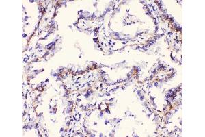 IHC analysis of Integrin alpha 3 using anti-Integrin alpha 3 antibody (ABIN6719410). (ITGA3 antibody)