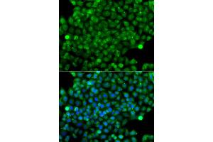 Immunofluorescence analysis of A549 cells using CFHR3 antibody (ABIN6294036). (CFHR3 antibody)
