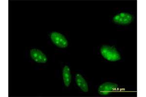 Immunofluorescence of purified MaxPab antibody to C2orf3 on HeLa cell. (GCFC2 antibody  (AA 1-215))